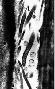 Electron micrograph of Ca. Liberibacter cells in a sieve tube of sweet orange leaf in Saudi Arabia 