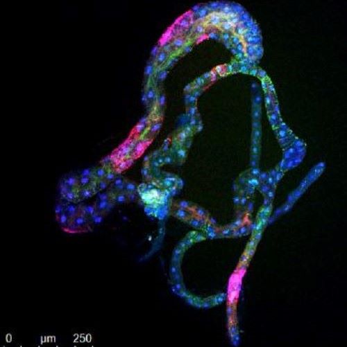 dissected psyllid gut with CLas stained in green color